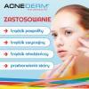 ACNE-DERM krem 20 g