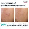 Eucerin DermoPure Clinical Kuracja złuszczająco-wygładzająca Kwasowy peeling na noc, 40 ml
