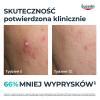 Eucerin DermoPure Clinical Serum o potrójnym działaniu, 40 ml