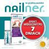 NAILNER lakier 2w1 do leczenia grzybicy paznokci 5 ml