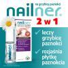 NAILNER lakier 2w1 do leczenia grzybicy paznokci 5 ml
